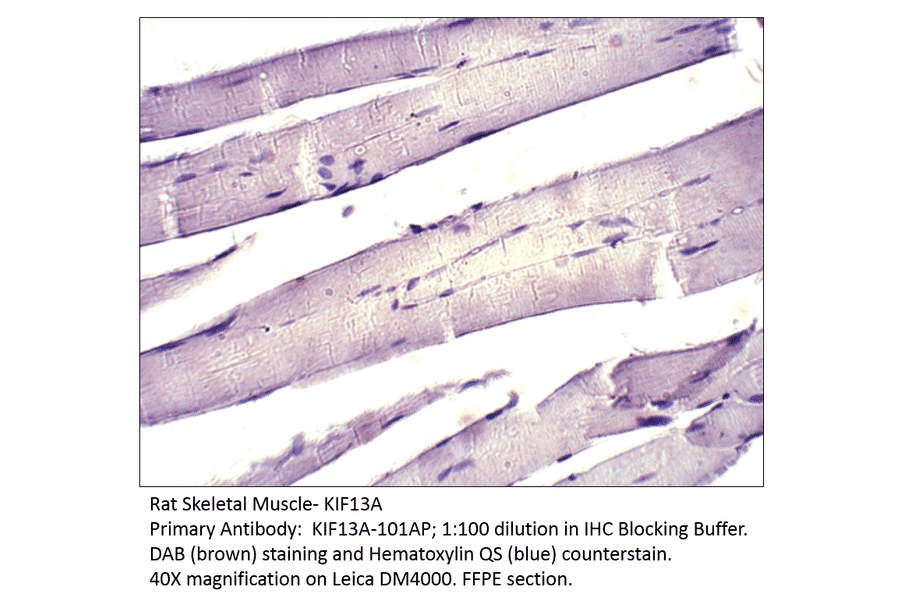 Anti-KIF13A Antibody from FabGennix (KIF13A-101AP) - Antibodies.com