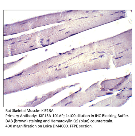 Anti-KIF13A Antibody from FabGennix (KIF13A-101AP) - Antibodies.com