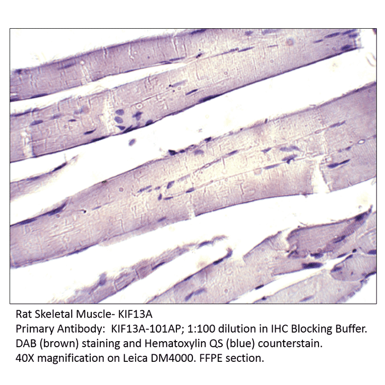 Anti-KIF13A Antibody from FabGennix (KIF13A-101AP) - Antibodies.com