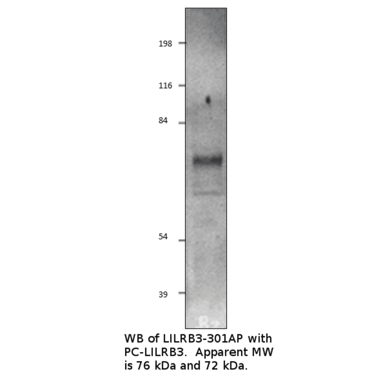 Anti-LILRB3 Antibody from FabGennix (LILRB3-301AP) - Antibodies.com