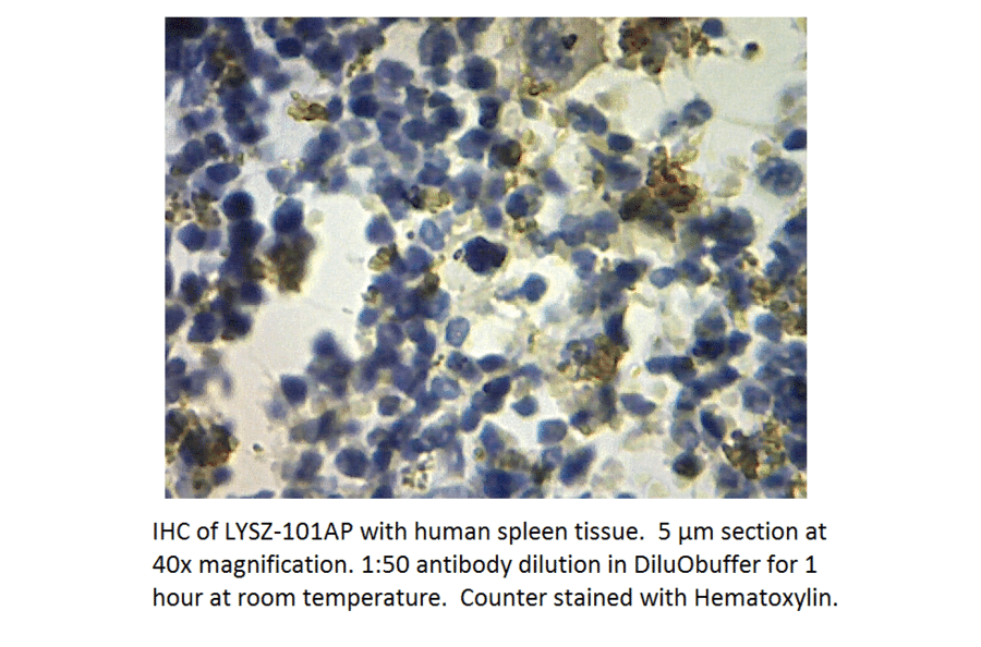 Anti-Lysozyme Antibody from FabGennix (LYSZ-101AP) - Antibodies.com
