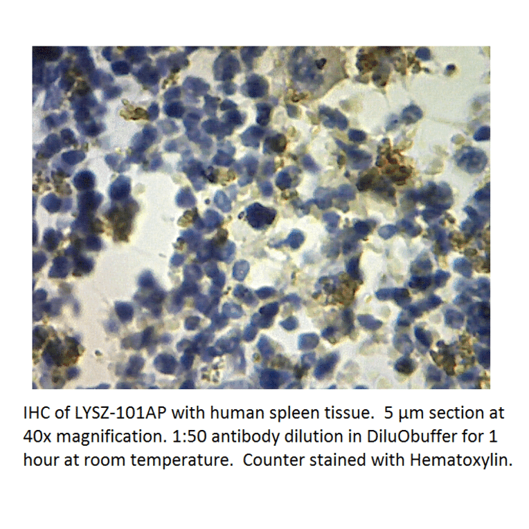 Anti-Lysozyme Antibody from FabGennix (LYSZ-101AP) - Antibodies.com