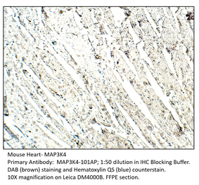 Anti-MAP3K4 Antibody from FabGennix (MAP3K4-101AP) - Antibodies.com