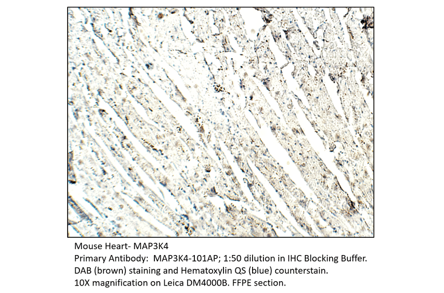 Anti-MAP3K4 Antibody from FabGennix (MAP3K4-101AP) - Antibodies.com