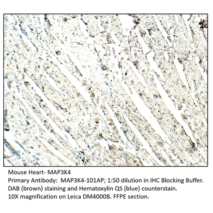 Anti-MAP3K4 Antibody from FabGennix (MAP3K4-101AP) - Antibodies.com