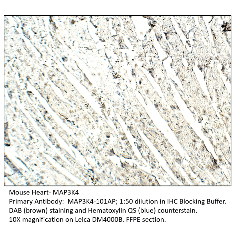 Anti-MAP3K4 Antibody from FabGennix (MAP3K4-101AP) - Antibodies.com