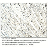 Anti-MAP3K4 Antibody from FabGennix (MAP3K4-101AP) - Antibodies.com