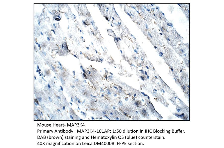 Anti-MAP3K4 Antibody from FabGennix (MAP3K4-101AP) - Antibodies.com