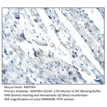 Anti-MAP3K4 Antibody from FabGennix (MAP3K4-101AP) - Antibodies.com