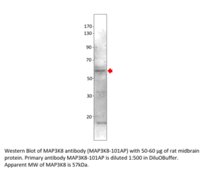 Anti-MAP3K8 Antibody from FabGennix (MAP3K8-101AP) - Antibodies.com