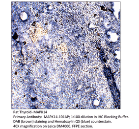 Anti-MAPK14 Antibody from FabGennix (MAPK14-101AP) - Antibodies.com