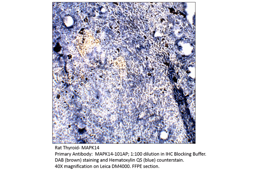 Anti-MAPK14 Antibody from FabGennix (MAPK14-101AP) - Antibodies.com