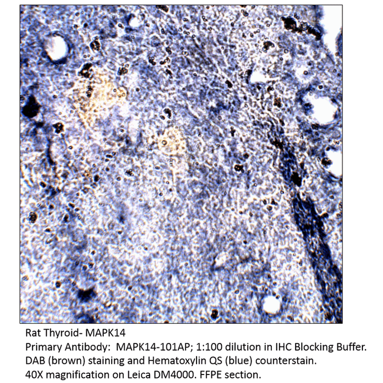Anti-MAPK14 Antibody from FabGennix (MAPK14-101AP) - Antibodies.com