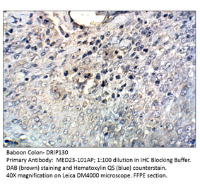 Anti-DRIP130 Antibody from FabGennix (MED23-101AP) - Antibodies.com