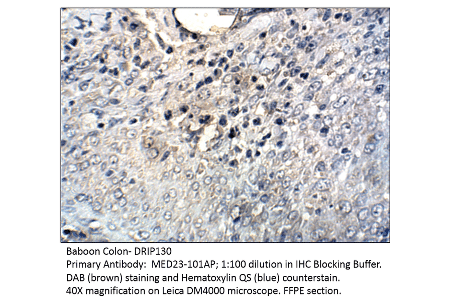 Anti-DRIP130 Antibody from FabGennix (MED23-101AP) - Antibodies.com