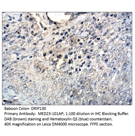 Anti-DRIP130 Antibody from FabGennix (MED23-101AP) - Antibodies.com