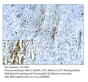 Anti-SLC12A1 Antibody from FabGennix (NKCC2-101AP) - Antibodies.com