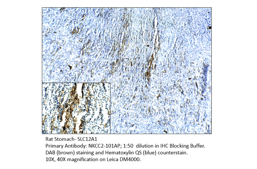 Anti-SLC12A1 Antibody from FabGennix (NKCC2-101AP) - Antibodies.com