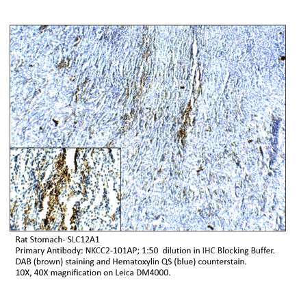 Anti-SLC12A1 Antibody from FabGennix (NKCC2-101AP) - Antibodies.com