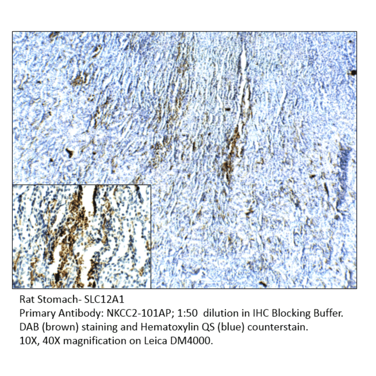 Anti-SLC12A1 Antibody from FabGennix (NKCC2-101AP) - Antibodies.com