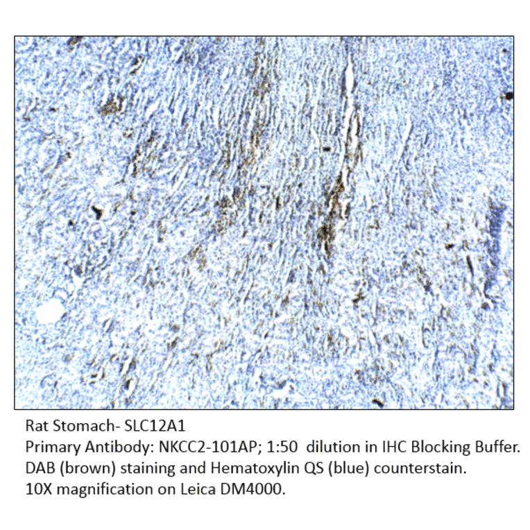 Anti-SLC12A1 Antibody from FabGennix (NKCC2-101AP) - Antibodies.com