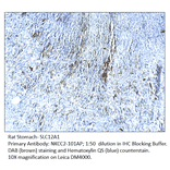 Anti-SLC12A1 Antibody from FabGennix (NKCC2-101AP) - Antibodies.com