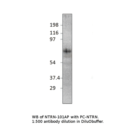 Anti-Netrin 1 Antibody from FabGennix (NTRN-101AP) - Antibodies.com