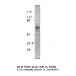 Anti-Netrin 1 Antibody from FabGennix (NTRN-101AP) - Antibodies.com
