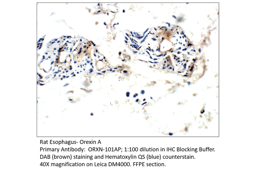 Anti-Orexin A Antibody from FabGennix (ORXN-101AP) - Antibodies.com