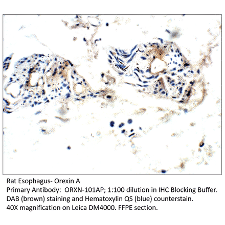 Anti-Orexin A Antibody from FabGennix (ORXN-101AP) - Antibodies.com
