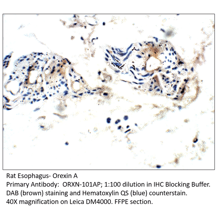 Anti-Orexin A Antibody from FabGennix (ORXN-101AP) - Antibodies.com