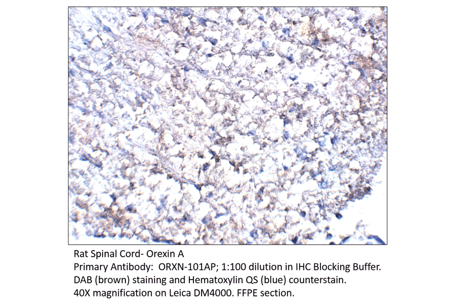 Anti-Orexin A Antibody from FabGennix (ORXN-101AP) - Antibodies.com
