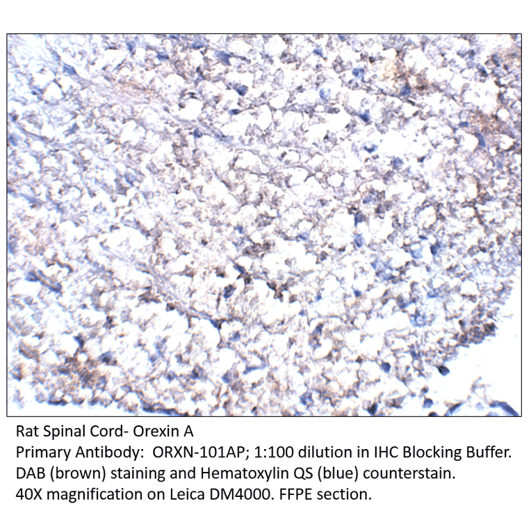 Anti-Orexin A Antibody from FabGennix (ORXN-101AP) - Antibodies.com