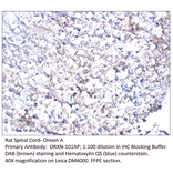 Anti-Orexin A Antibody from FabGennix (ORXN-101AP) - Antibodies.com