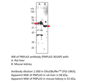 Anti-PNPLA3 Antibody from FabGennix (PNPLA3-301AP) - Antibodies.com