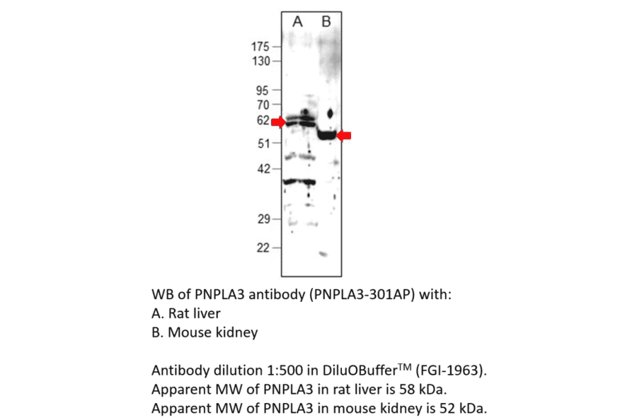 Anti-PNPLA3 Antibody from FabGennix (PNPLA3-301AP) - Antibodies.com