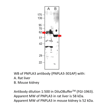 Anti-PNPLA3 Antibody from FabGennix (PNPLA3-301AP) - Antibodies.com