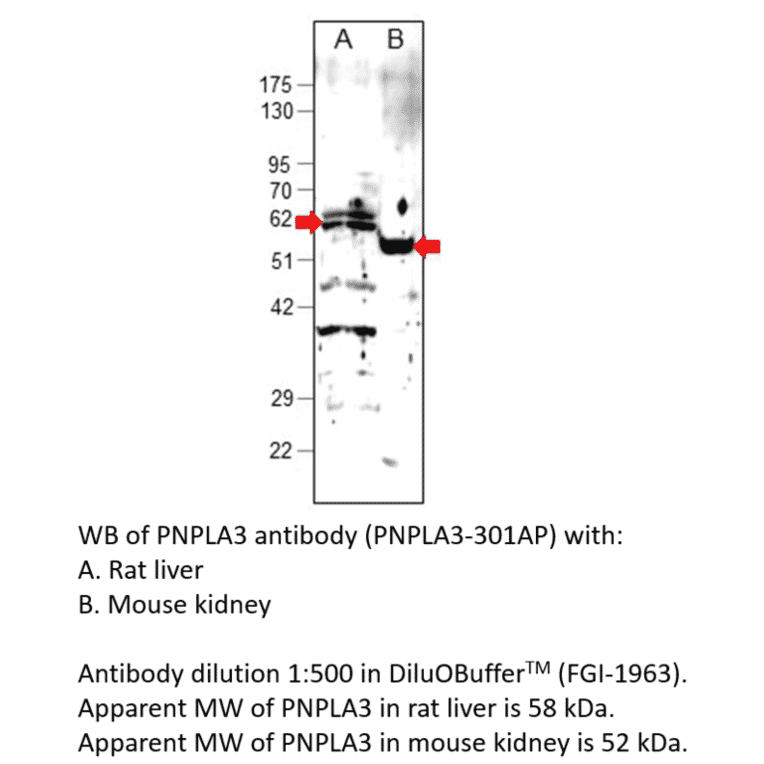 Anti-PNPLA3 Antibody from FabGennix (PNPLA3-301AP) - Antibodies.com