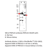 Anti-PNPLA3 Antibody from FabGennix (PNPLA3-301AP) - Antibodies.com