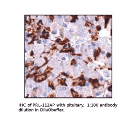 Anti-Prolactin Antibody from FabGennix (PRL-112AP) - Antibodies.com