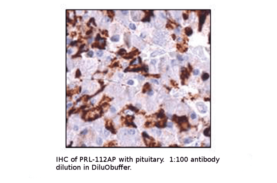 Anti-Prolactin Antibody from FabGennix (PRL-112AP) - Antibodies.com