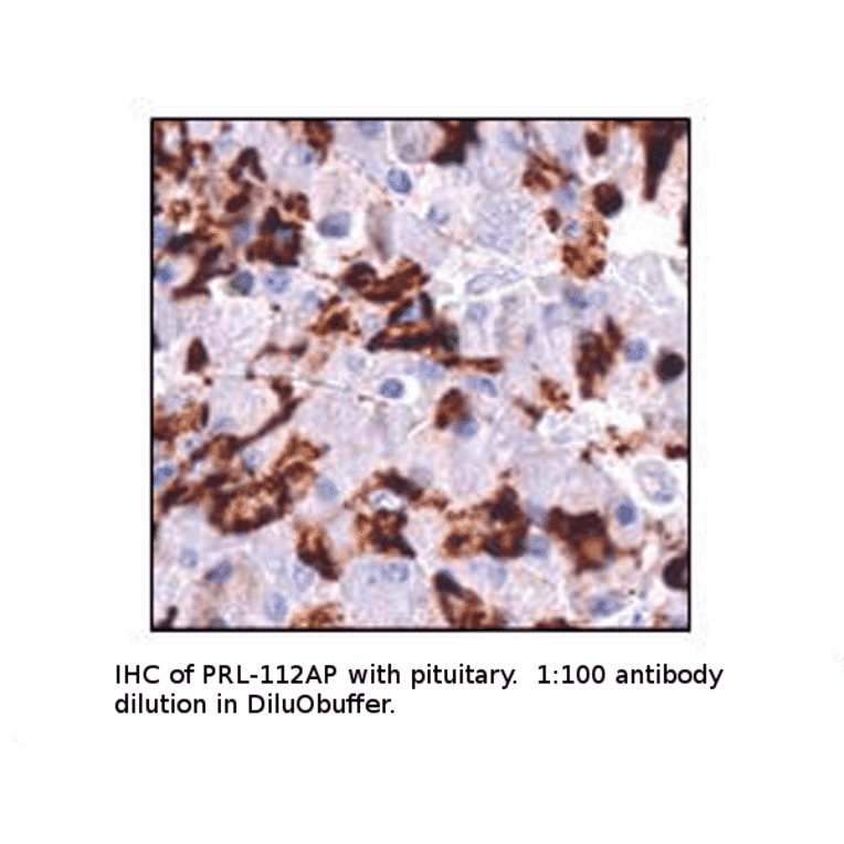 Anti-Prolactin Antibody from FabGennix (PRL-112AP) - Antibodies.com