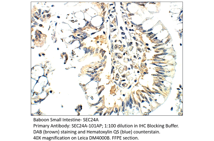 Anti-SEC24A Antibody from FabGennix (SEC24A-101AP) - Antibodies.com
