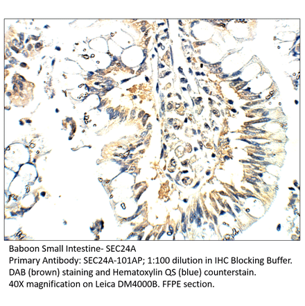 Anti-SEC24A Antibody from FabGennix (SEC24A-101AP) - Antibodies.com