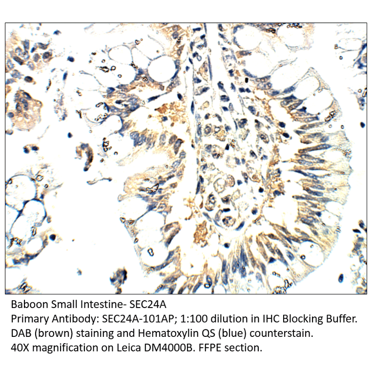 Anti-SEC24A Antibody from FabGennix (SEC24A-101AP) - Antibodies.com