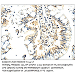 Anti-SEC24A Antibody from FabGennix (SEC24A-101AP) - Antibodies.com