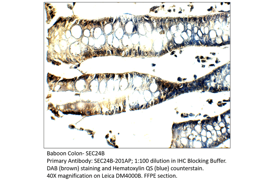 Anti-SEC24B Antibody from FabGennix (SEC24B-201AP) - Antibodies.com