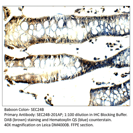 Anti-SEC24B Antibody from FabGennix (SEC24B-201AP) - Antibodies.com