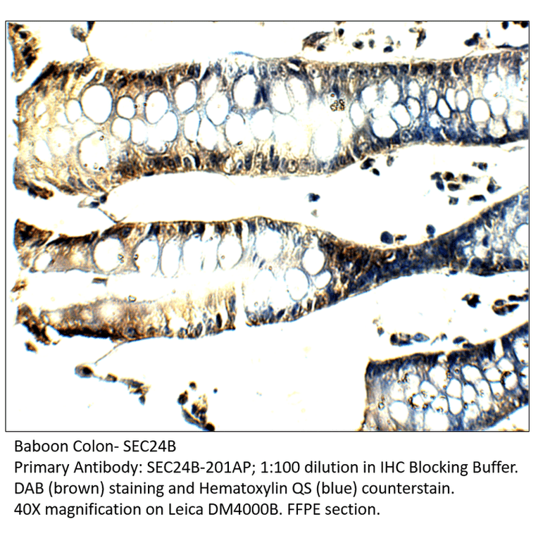 Anti-SEC24B Antibody from FabGennix (SEC24B-201AP) - Antibodies.com