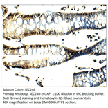 Anti-SEC24B Antibody from FabGennix (SEC24B-201AP) - Antibodies.com